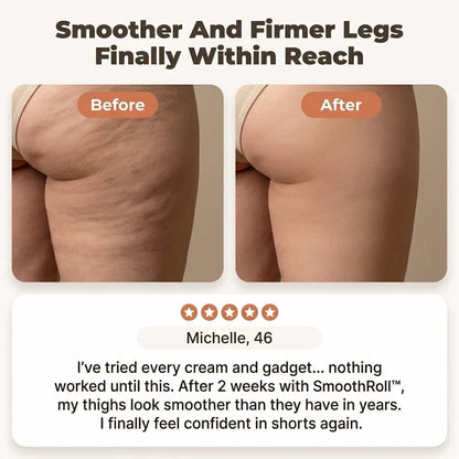 SmoothRoll™ - Réducteur de cellulite à 360 degrés