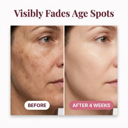 FreshTone™ - Vitamin Illuminating Serum for Dark Spot Correction