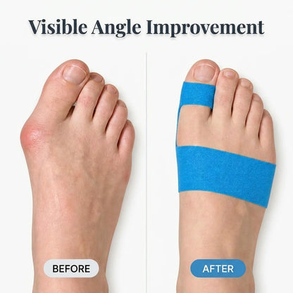 Quietstep™ – Discreet Elastic Bunion Wrap for All-Day Pain Relief