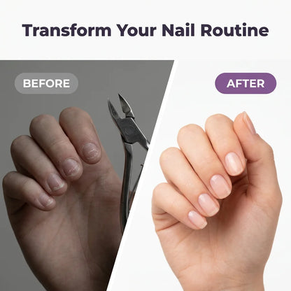 SmartTrim™ - 2-in-1 professional salon-quality nail clipper and polisher